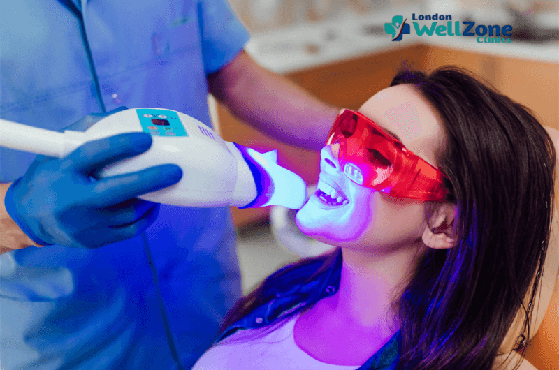 Laser Teeth Whitening in the UK: How Long Does It Last and Is It Worth It?